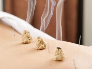 【鍼灸の疑問を完全解決】痛くない？本当に効くの？専門家が徹底解説するブログで、あなたの長年の悩みに終止符を！